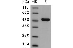 Western Blotting (WB) image for Advanced Glycosylation End Product-Specific Receptor (AGER) (Active) protein (His tag) (ABIN7320260)
