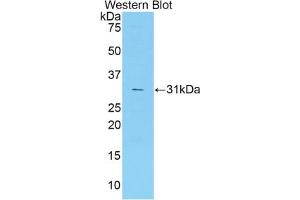 Western blot analysis of the recombinant protein. (Coagulation Factor V anticorps  (AA 1776-2028))