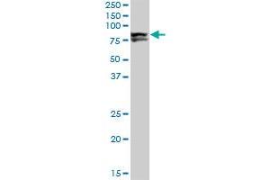 LIMK1 monoclonal antibody (M01), clone 1A8. (LIM Domain Kinase 1 anticorps  (AA 548-647))
