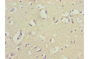 Immunohistochemistry of paraffin-embedded human brain tissue using ABIN7149150 at dilution of 1:100