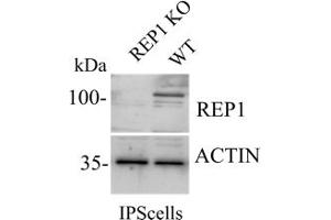 Western Blotting (WB) image for anti-Choroideremia (Rab Escort Protein 1) (CHM) (C-Term) antibody (ABIN6254221)