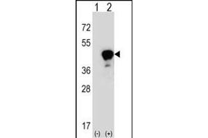 Western blot analysis of LRG1 (arrow) using rabbit polyclonal LRG1 Antibody (Center) (ABIN390660 and ABIN2840956). (LRG1 anticorps  (AA 194-223))