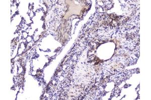 IHC analysis of Hsp27 using anti-Hsp27 antibody (ABIN6719322).