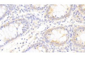 Detection of TIRAP in Porcine Colon Tissue using Polyclonal Antibody to Toll Interleukin 1 Receptor Domain Containing Adaptor Protein (TIRAP)