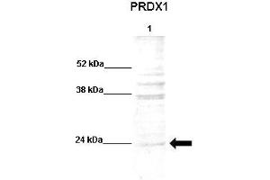 WB Suggested Anti-PRDX1 Antibody    Positive Control:  Lane 1: 20ug human dental pulp stem cell lysate  Primary Antibody Dilution :   1:500  Secondary Antibody :  Anti-rabbit-AP  Secondry Antibody Dilution :   1:500  Submitted by:  Luis Eduardo Soares Netto