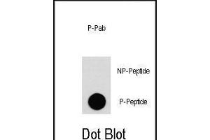 Dot blot analysis of anti-EGFR-p Phospho-specific Pab (ABIN1881285 and ABIN2850456) on nitrocellulose membrane.
