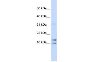 WB Suggested Anti-IL15 Antibody Titration: 0. (IL-15 anticorps  (N-Term))