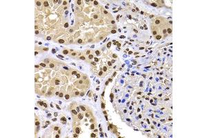 Immunohistochemistry of paraffin-embedded human kidney using HIRIP3 antibody (ABIN5974221) at dilution of 1/100 (40x lens). (HIRIP3 anticorps)