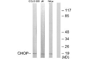 Immunohistochemistry analysis of paraffin-embedded human skeletal muscle tissue using CHOP (Ab-30) antibody. (DDIT3 anticorps  (Ser30))