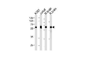 USP14 Antibody (N-term) (ABIN1882288 and ABIN2843485) western blot analysis in k562,Jurkat cell line ,mouse brain and rat brain tissue lysates (35 μg/lane). (USP14 anticorps)