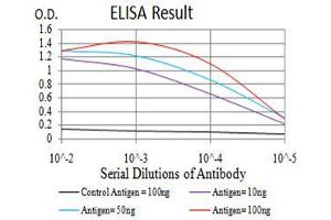 Black line: Control Antigen (100 ng),Purple line: Antigen (10 ng), Blue line: Antigen (50 ng), Red line:Antigen (100 ng)