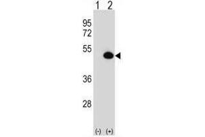 Western blot analysis of ASS1 (arrow) using rabbit polyclonal ASS1 Antibody (C-term) .