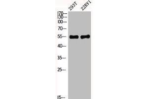 Western Blot analysis of 293T 22RV1 cells using Phospho-Akt1 (Y474) Polyclonal Antibody (AKT1 anticorps  (pTyr474))