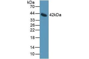 Detection of IL11Ra in Mouse Serum using Polyclonal Antibody to Interleukin 11 Receptor Alpha (IL11Ra) (IL11RA anticorps  (AA 194-329))