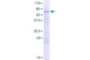 Image no. 1 for Ligand Dependent Nuclear Receptor Corepressor (Lcor) (AA 1-406) protein (GST tag) (ABIN1309242)