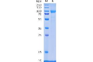 Human CD114 Protein, His Tag on SDS-PAGE under reducing condition.