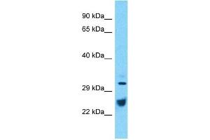 Host:  Rabbit  Target Name:  ATP1B1  Sample Type:  Thymus Tumor lysates  Antibody Dilution:  1. (ATP1B1 anticorps  (C-Term))