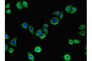 Immunofluorescent analysis of PC-3 cells using ABIN7148281 at dilution of 1:100 and Alexa Fluor 488-congugated AffiniPure Goat Anti-Rabbit IgG(H+L)