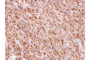 IHC-P Image Immunohistochemical analysis of paraffin-embedded U87 xenograft, using TTC30A, antibody at 1:100 dilution. (TTC30A anticorps)