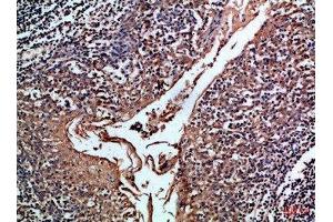 Immunohistochemical analysis of paraffin-embedded Human-tonsil, antibody was diluted at 1:100