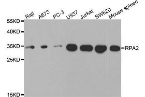 Western blot analysis of extracts of various cell lines, using RPA2 antibody. (RPA2 anticorps)