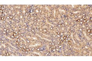 Detection of GSN in Rat Kidney Tissue using Polyclonal Antibody to Gelsolin (GSN)