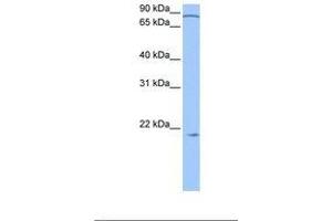 Image no. 1 for anti-Actin Related Protein 2/3 Complex, Subunit 3, 21kDa (ARPC3) (N-Term) antibody (ABIN6738810)
