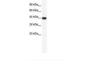 Image no. 1 for anti-Integrin-Binding Sialoprotein (IBSP) (AA 108-157) antibody (ABIN202229) (IBSP anticorps  (AA 108-157))