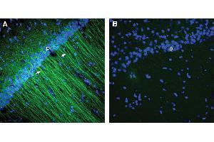 Expression of CCR2 in rat hippocampus. (CCR2 anticorps  (Extracellular))