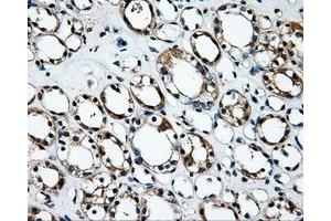 Immunohistochemical staining of paraffin-embedded Kidney tissue using anti-RALBP1mouse monoclonal antibody. (RALBP1 anticorps)