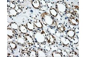 Immunohistochemical staining of paraffin-embedded Kidney tissue using anti-RALBP1mouse monoclonal antibody.