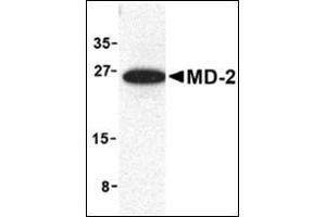 Western blot analysis of MD-2 in mouse spleen cell lysate with this product at 1 μg/ml. (LY96 anticorps  (Center))
