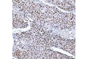 IHC analysis of FEN1 using anti-FEN1 antibody (ABIN7601617). (FEN1 anticorps  (AA 4-300))