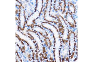 Immunohistochemistry of paraffin-embedded Rat kidney using IL23R Rabbit pAb (ABIN3022245, ABIN3022246, ABIN3022247, ABIN1513088 and ABIN6218691) at dilution of 1:100 (40x lens).