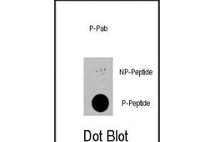 Dot blot analysis of anti-PDPK1-p Phospho-specific Pab (R) on nitrocellulose membrane. (PDPK1 anticorps  (pSer396))