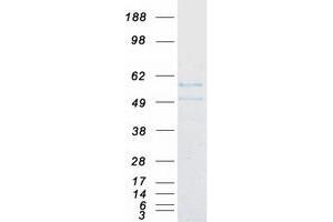 Validation with Western Blot