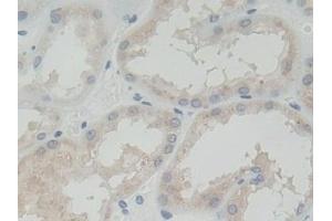 Detection of ROR2 in Human Kidney Tissue using Polyclonal Antibody to Receptor Tyrosine Kinase Like Orphan Receptor 2 (ROR2) (ROR2 anticorps  (AA 683-934))