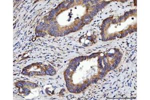 IHC analysis of RRS1 using anti-RRS1 antibody (ABIN7602918).