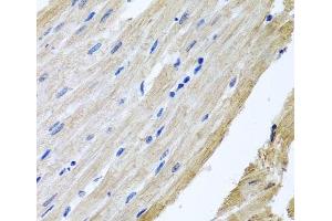 Immunohistochemistry of paraffin-embedded Rat heart using PRPH Polyclonal Antibody at dilution of 1:100 (40x lens). (Peripherin anticorps)