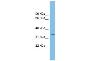 PCGF6 antibody used at 1 ug/ml to detect target protein. (PCGF6 anticorps  (Middle Region))