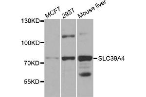 Western blot analysis of extracts of various cell lines, using SLC39A4 antibody (ABIN5971796) at 1/1000 dilution. (SLC39A4 anticorps)
