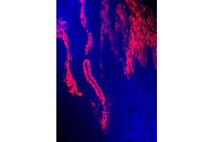 human sole (courtesy of L.