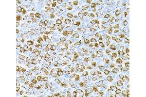 Immunohistochemistry of paraffin-embedded Mouse stomach using DLK1 Polyclonal Antibody at dilution of 1:100 (40x lens). (DLK1 anticorps)