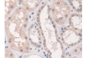 Detection of STX1A in Human Kidney Tissue using Polyclonal Antibody to Syntaxin 1A, Brain (STX1A)