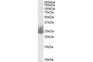 Image no. 1 for anti-Synaptosomal-Associated Protein, 25kDa (SNAP25) (C-Term) antibody (ABIN374554) (SNAP25 anticorps  (C-Term))