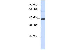 PHF6 antibody used at 0. (PHF6 anticorps  (C-Term))
