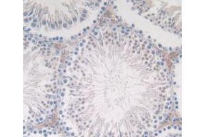 Detection of CT in Rat Testis Tissue using Monoclonal Antibody to Calcitonin (CT)