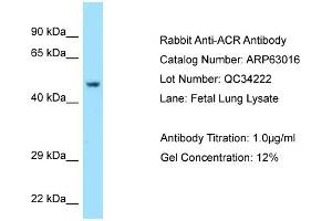 Western Blotting (WB) image for anti-Acrosin (ACR) (C-Term) antibody (ABIN2789340)
