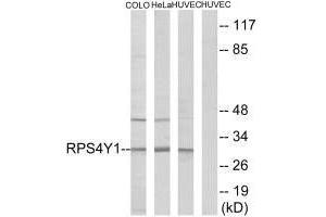 Western blot analysis of extracts from COLO cells, HeLa cells and HUVEC cells, using RPS4Y1 antibody. (RPS4Y1 anticorps  (C-Term))