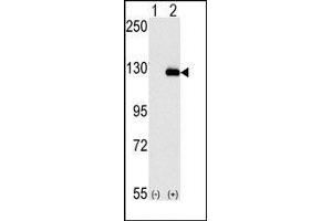Image no. 1 for anti-Budding Uninhibited By Benzimidazoles 1 Homolog beta (Yeast) (BUB1B) (N-Term) antibody (ABIN360515) (BUB1B anticorps  (N-Term))